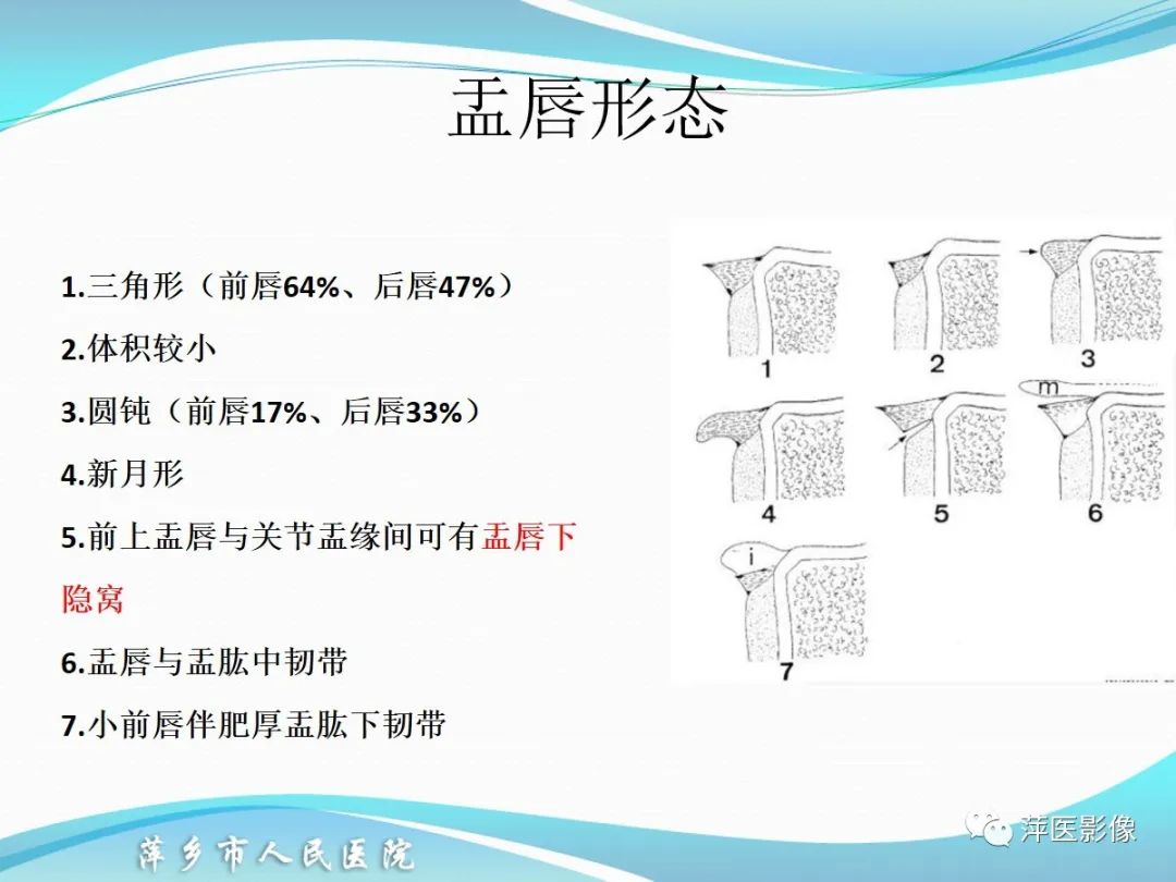 影像PPT - 【PPT】肩关节磁共振读片-47
