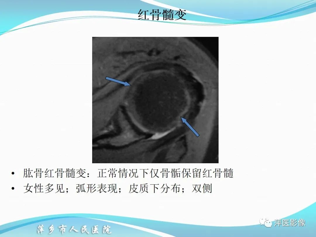影像PPT - 【PPT】肩关节磁共振读片-53