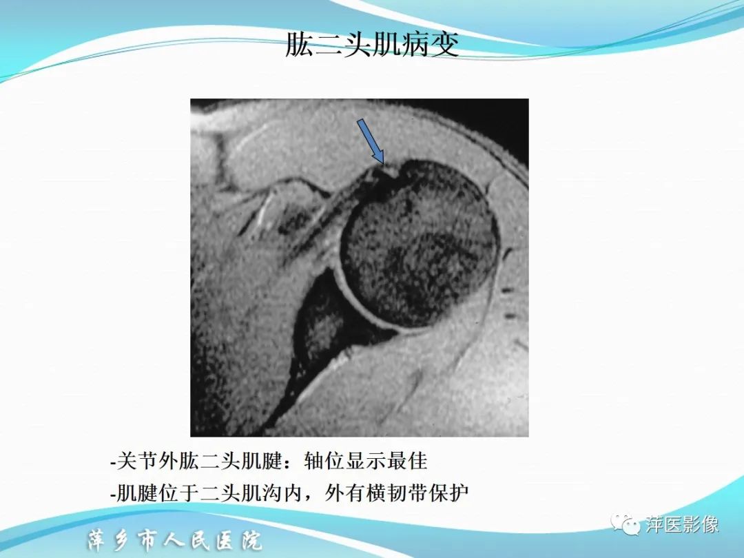 影像PPT - 【PPT】肩关节磁共振读片-61