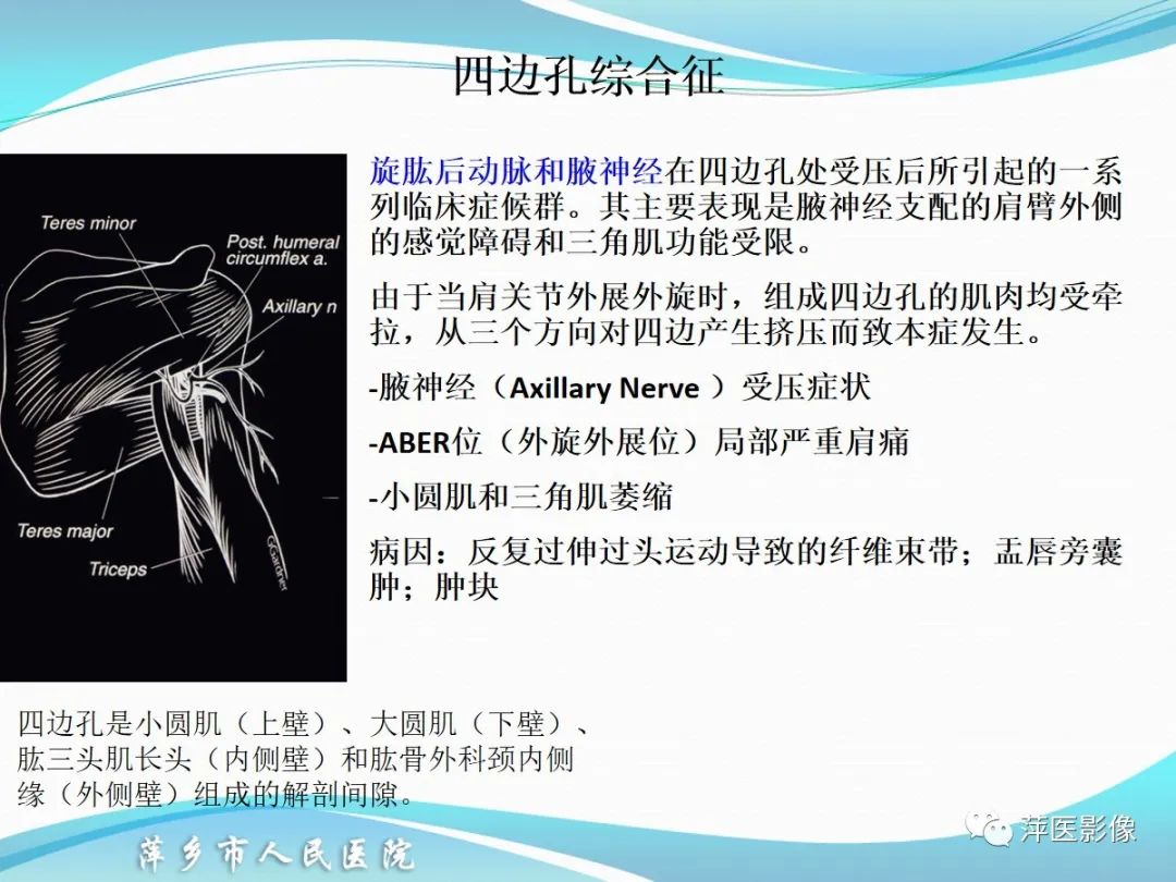 影像PPT - 【PPT】肩关节磁共振读片-70