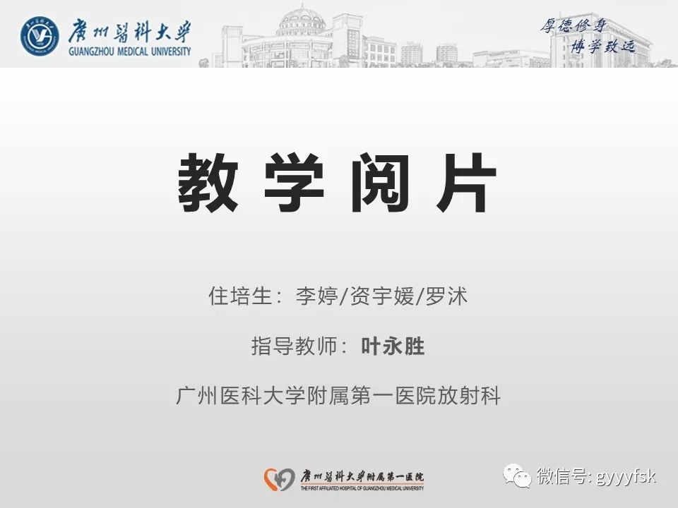 影像PPT - 【PPT】肾假性动脉瘤-1