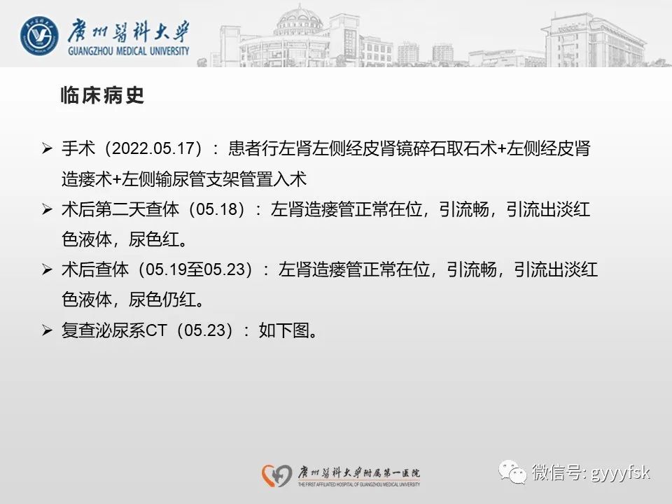 影像PPT - 【PPT】肾假性动脉瘤-4