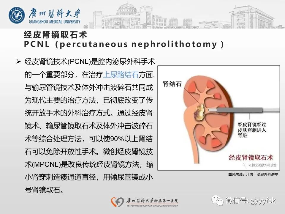 影像PPT - 【PPT】肾假性动脉瘤-8