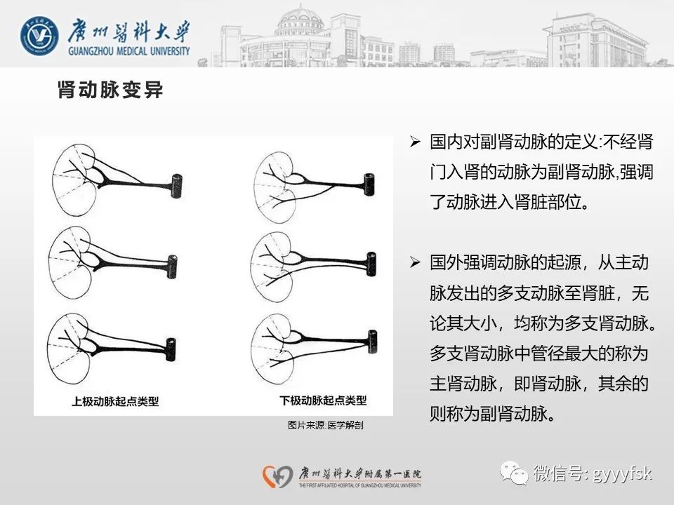 影像PPT - 【PPT】肾假性动脉瘤-17