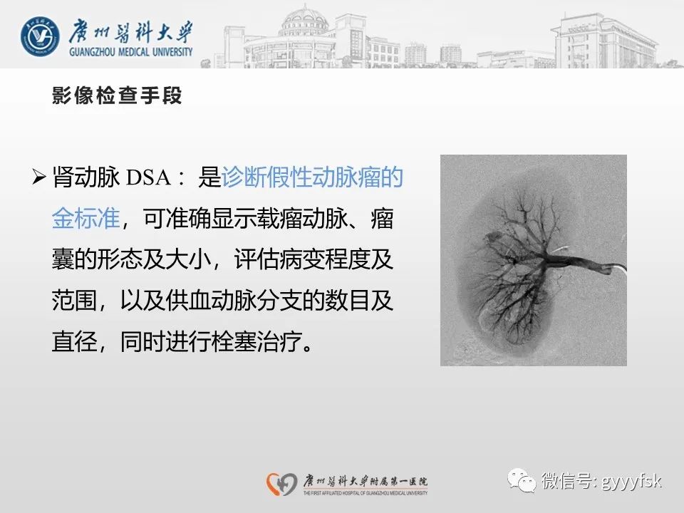 影像PPT - 【PPT】肾假性动脉瘤-23