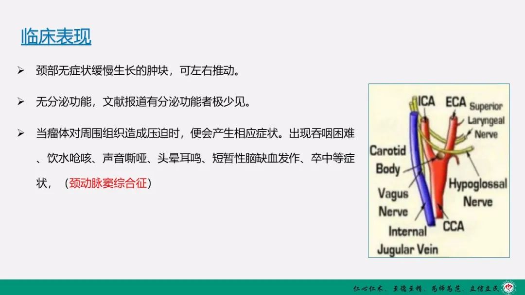 影像PPT - 【PPT】颈动脉体瘤（CBT）影像表现及临床分型-4