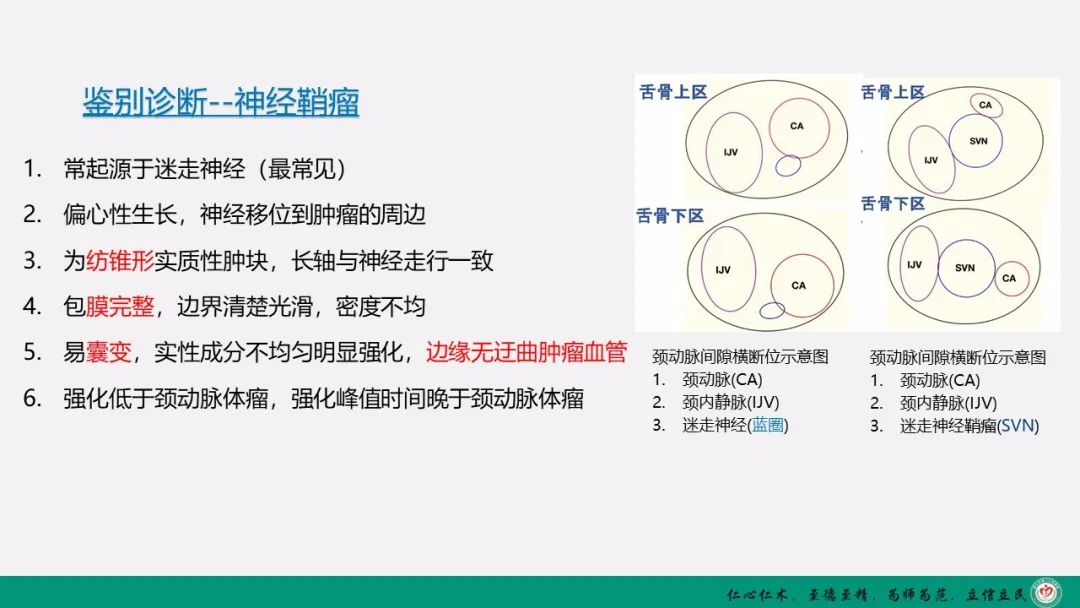 影像PPT - 【PPT】颈动脉体瘤（CBT）影像表现及临床分型-10