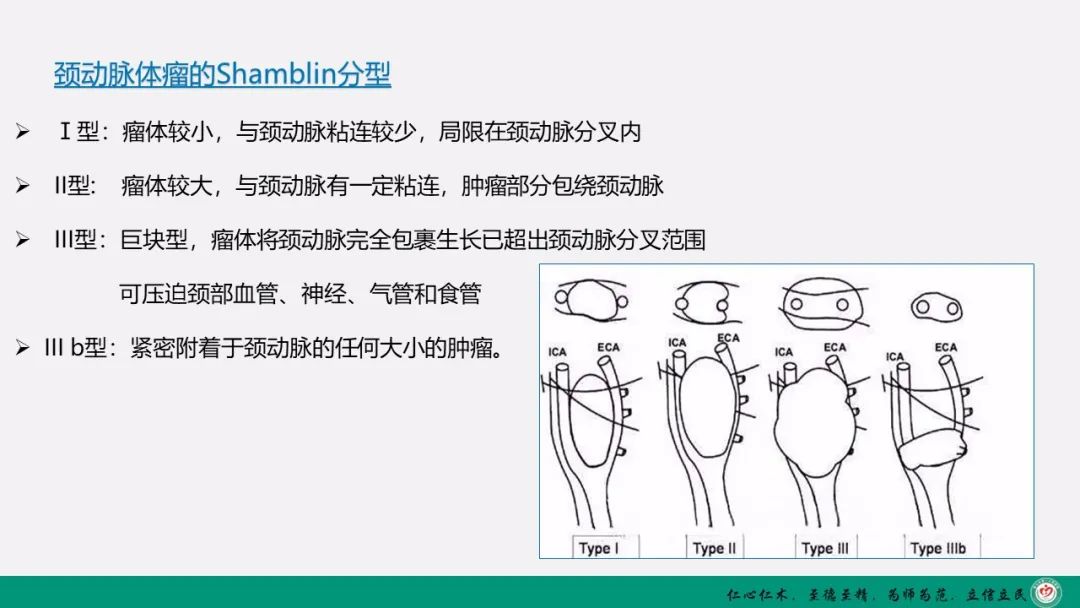 影像PPT - 【PPT】颈动脉体瘤（CBT）影像表现及临床分型-12
