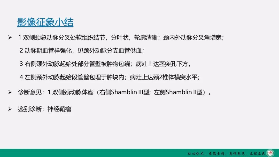 影像PPT - 【PPT】颈动脉体瘤（CBT）影像表现及临床分型-29