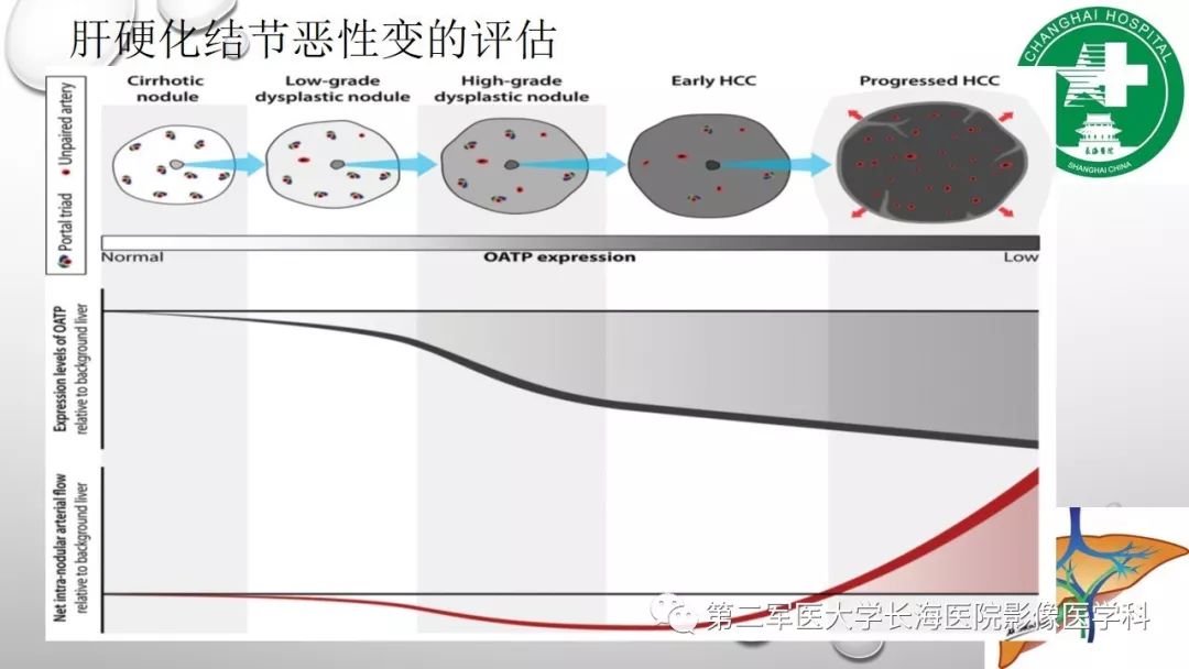 影像PPT - 【PPT】肝胆特异性MRI对比剂—钆塞酸二钠Gd-EOB-DTPA-15