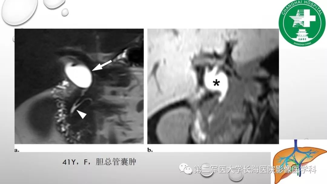 影像PPT - 【PPT】肝胆特异性MRI对比剂—钆塞酸二钠Gd-EOB-DTPA-32