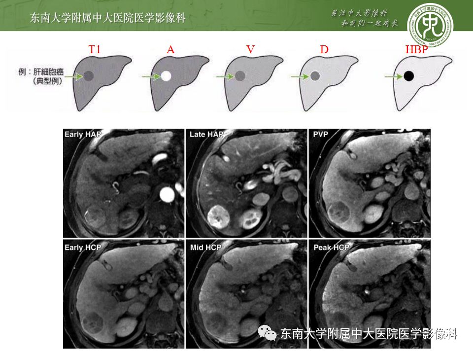 影像PPT - 【PPT】肝胆特异性MRI对比剂—钆塞酸二钠Gd-EOB-DTPA-42