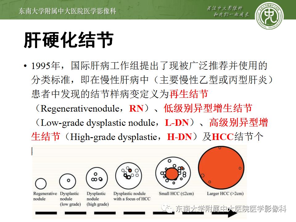 影像PPT - 【PPT】肝胆特异性MRI对比剂—钆塞酸二钠Gd-EOB-DTPA-44