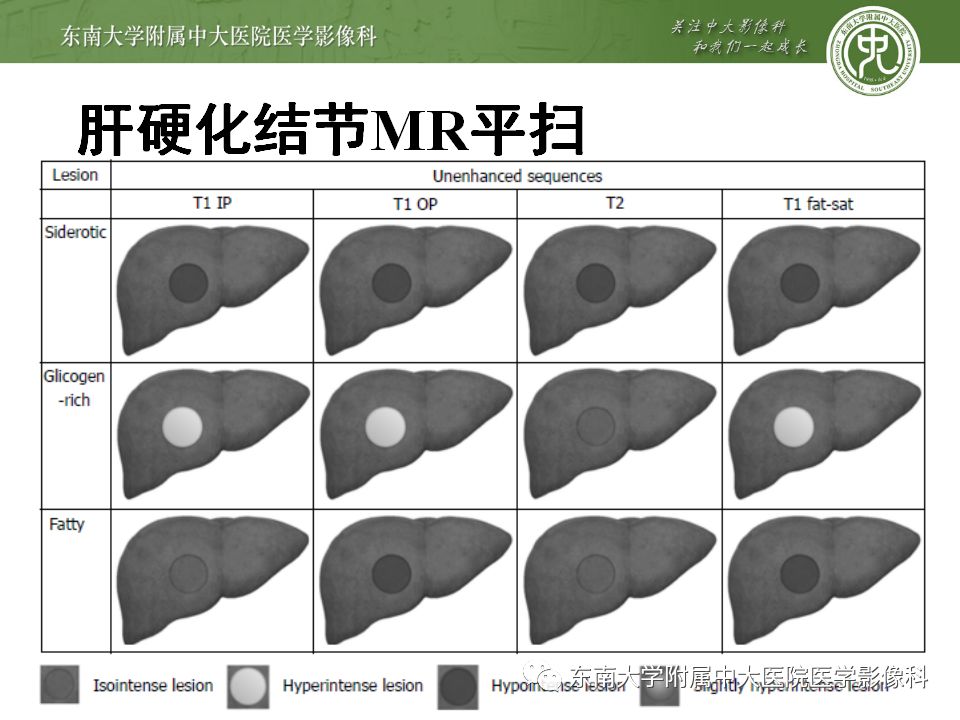 影像PPT - 【PPT】肝胆特异性MRI对比剂—钆塞酸二钠Gd-EOB-DTPA-45