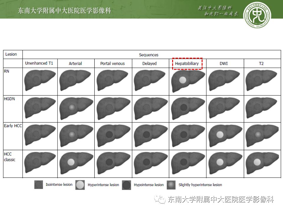 影像PPT - 【PPT】肝胆特异性MRI对比剂—钆塞酸二钠Gd-EOB-DTPA-51
