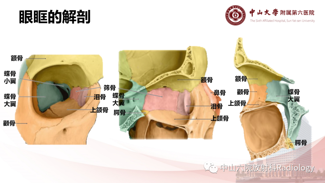 影像PPT - 【PPT】眶内血管瘤影像学表现-3