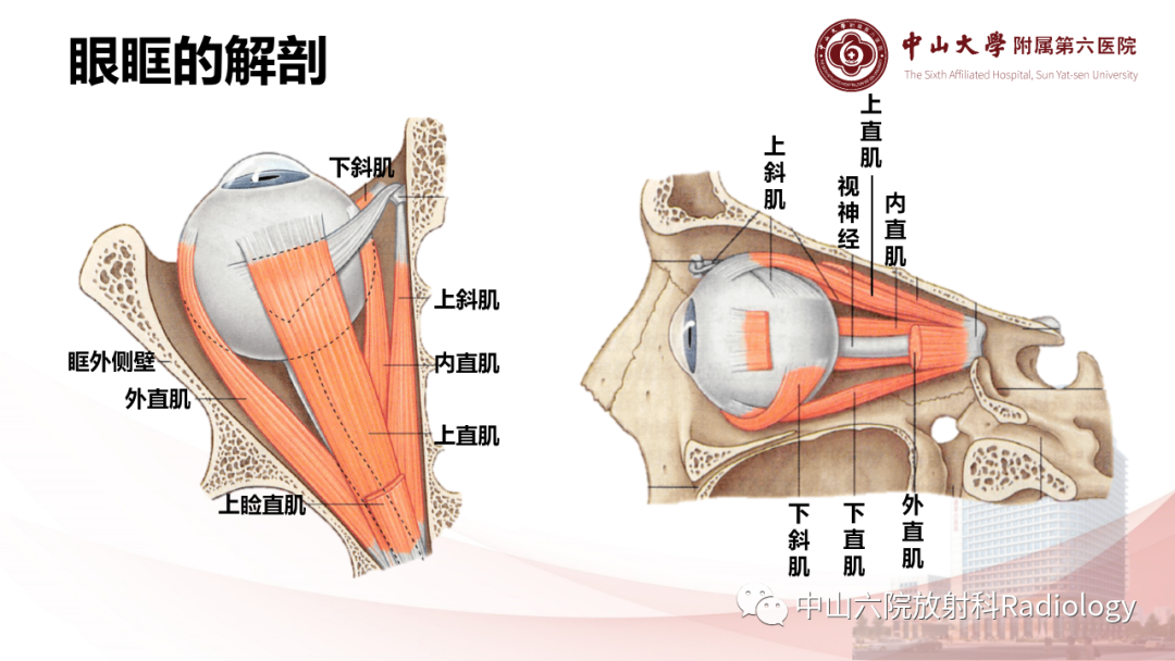 影像PPT - 【PPT】眶内血管瘤影像学表现-4