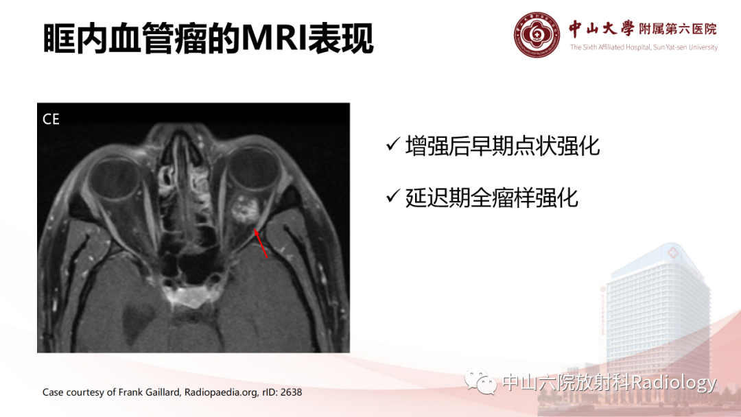 影像PPT - 【PPT】眶内血管瘤影像学表现-13