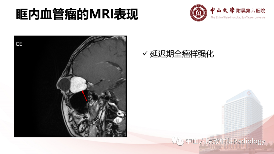 影像PPT - 【PPT】眶内血管瘤影像学表现-14