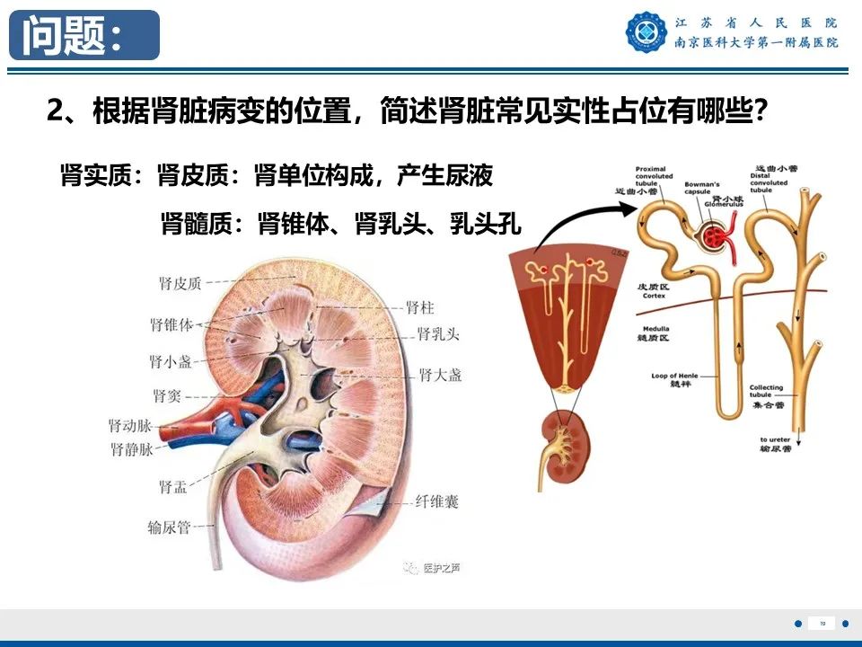 影像PPT - 【PPT】透明细胞癌-20