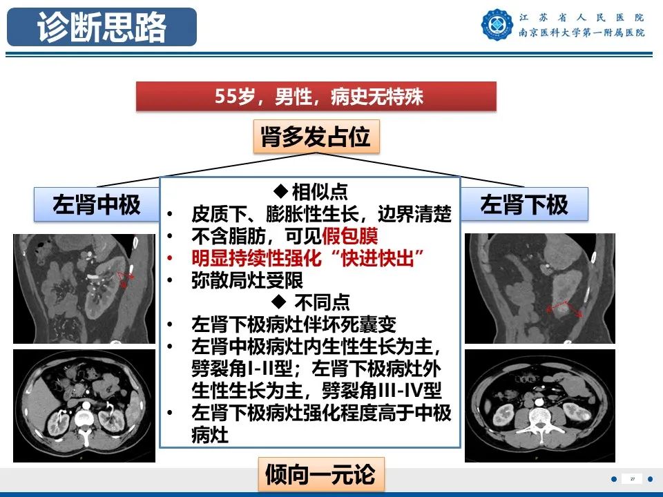 影像PPT - 【PPT】透明细胞癌-28