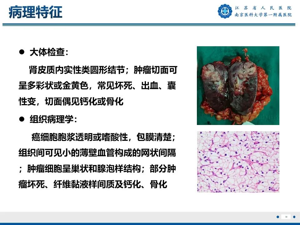 影像PPT - 【PPT】透明细胞癌-34