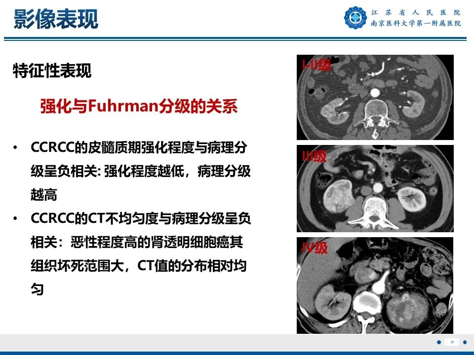 影像PPT - 【PPT】透明细胞癌-38