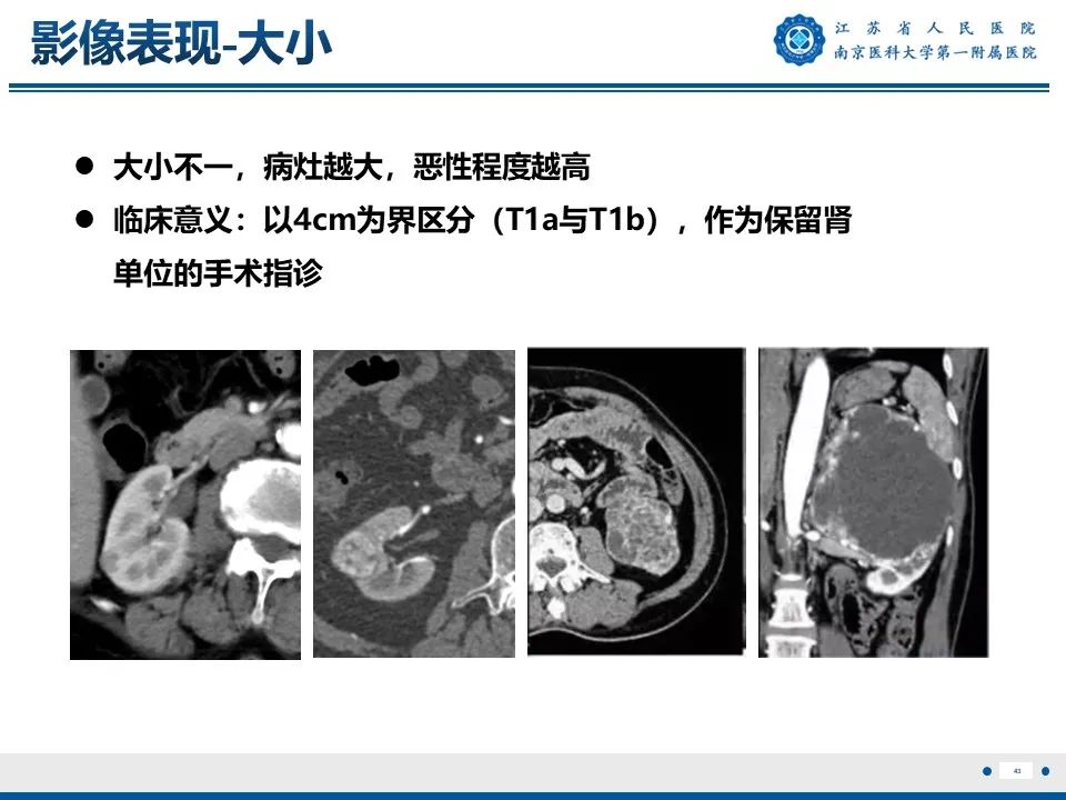 影像PPT - 【PPT】透明细胞癌-44