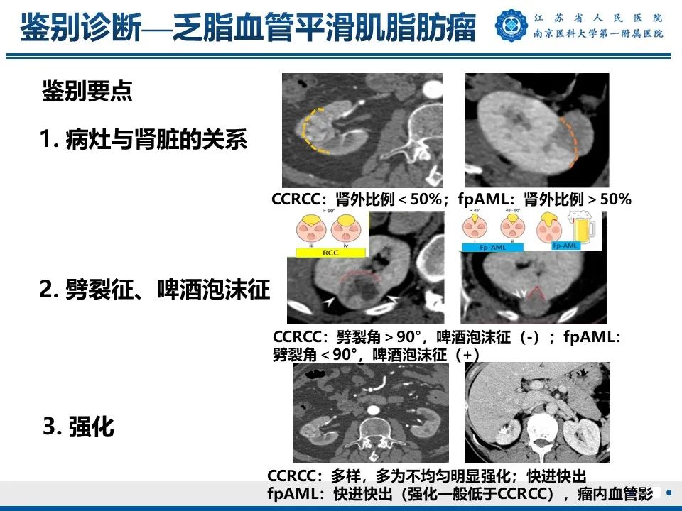 影像PPT - 【PPT】透明细胞癌-55