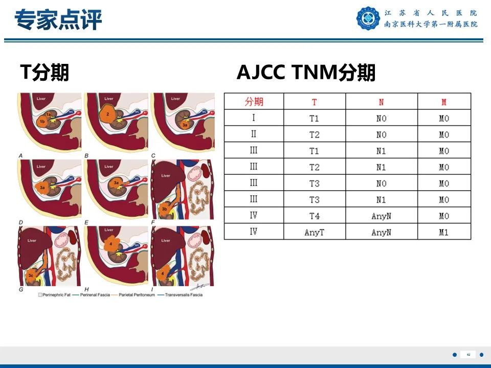 影像PPT - 【PPT】透明细胞癌-63