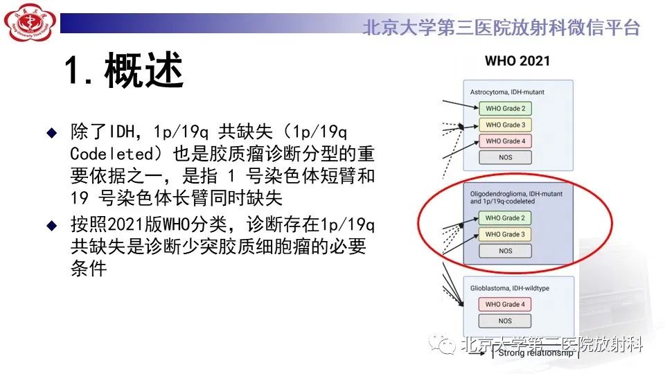 影像PPT - 【PPT】低级别星形细胞瘤中的T2/Flair不匹配征-4