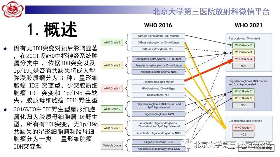 影像PPT - 【PPT】低级别星形细胞瘤中的T2/Flair不匹配征-5