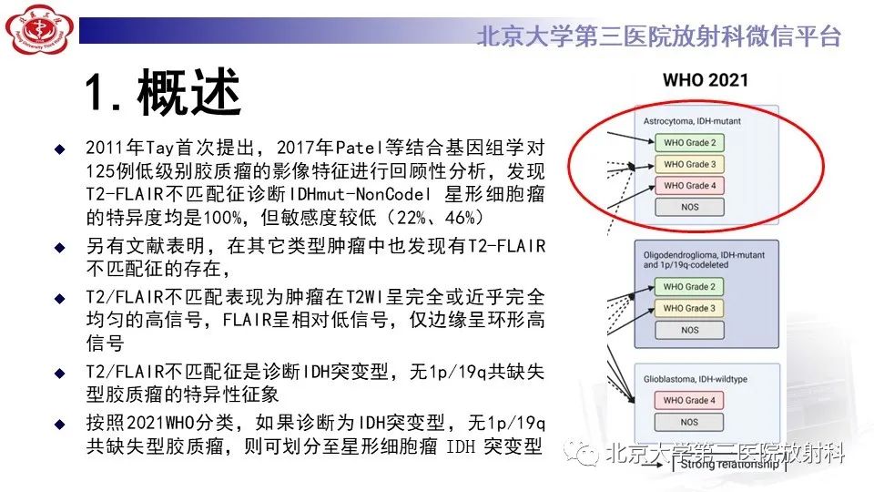 影像PPT - 【PPT】低级别星形细胞瘤中的T2/Flair不匹配征-6