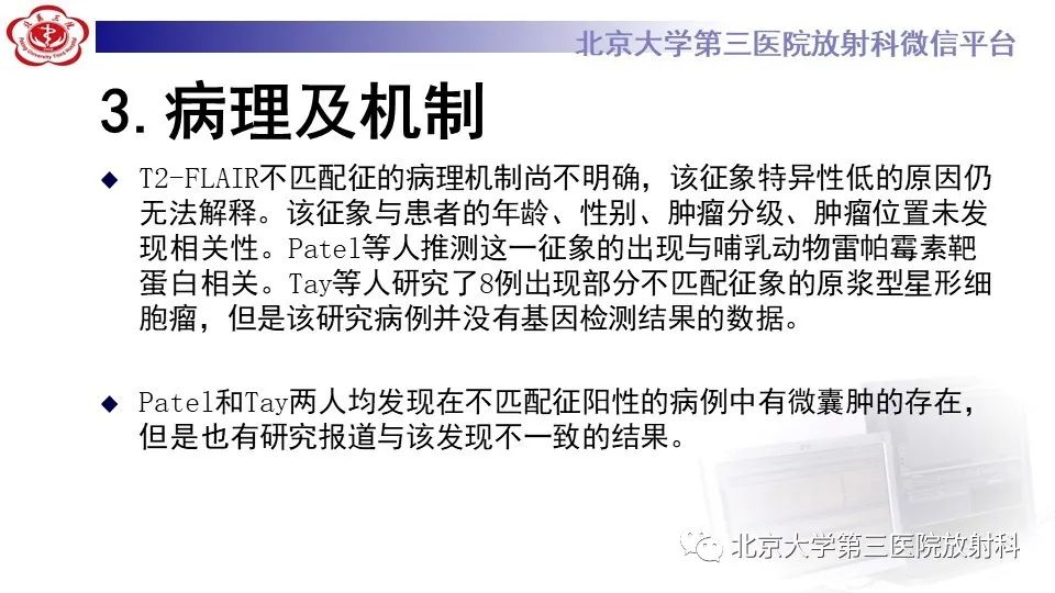 影像PPT - 【PPT】低级别星形细胞瘤中的T2/Flair不匹配征-8
