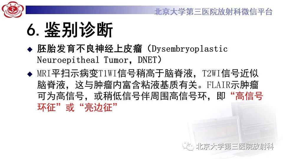影像PPT - 【PPT】低级别星形细胞瘤中的T2/Flair不匹配征-16