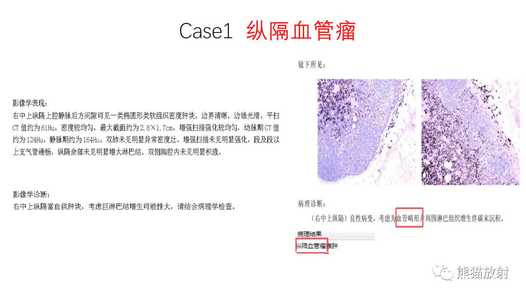 影像PPT - 【PPT】纵隔血管瘤 VS Castleman病-13