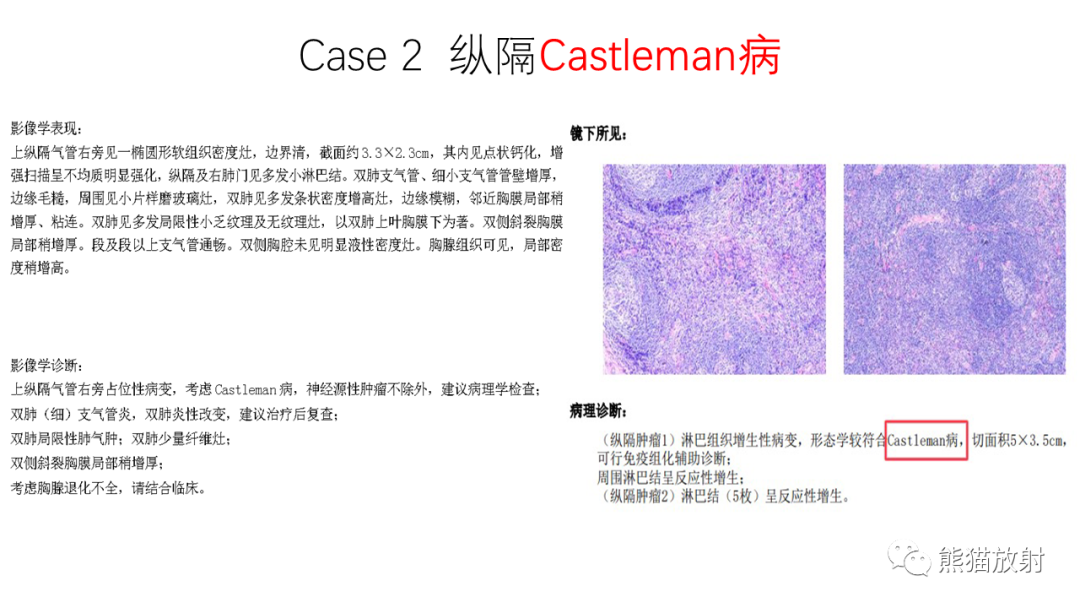 影像PPT - 【PPT】纵隔血管瘤 VS Castleman病-14