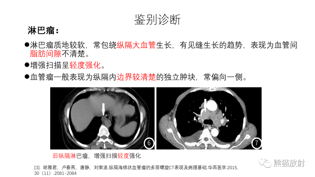 影像PPT - 【PPT】纵隔血管瘤 VS Castleman病-32