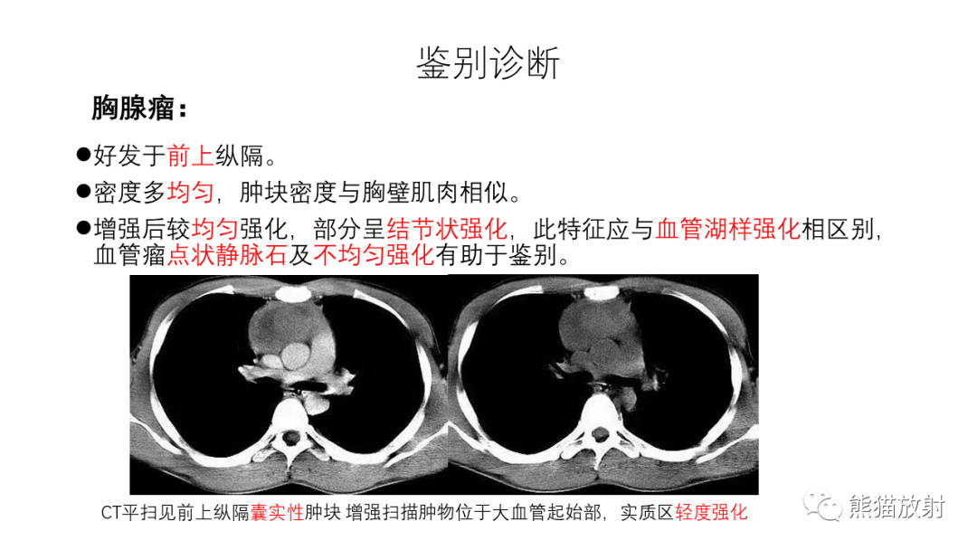 影像PPT - 【PPT】纵隔血管瘤 VS Castleman病-33