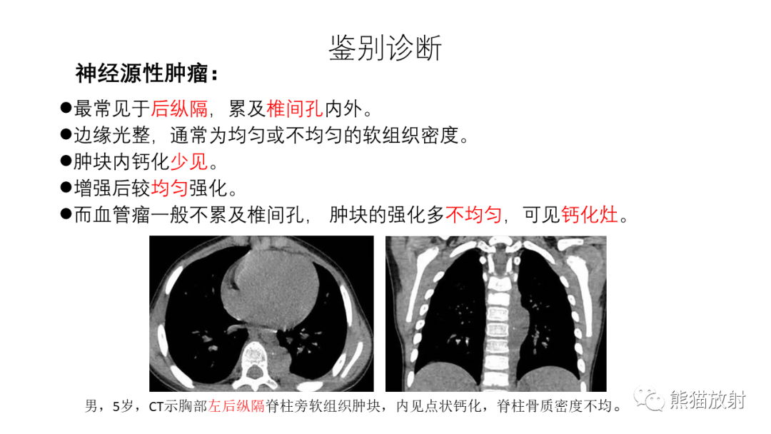 影像PPT - 【PPT】纵隔血管瘤 VS Castleman病-35