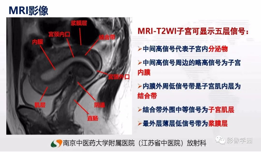 影像PPT - 【PPT】子宫内膜癌MR诊断与鉴别-9