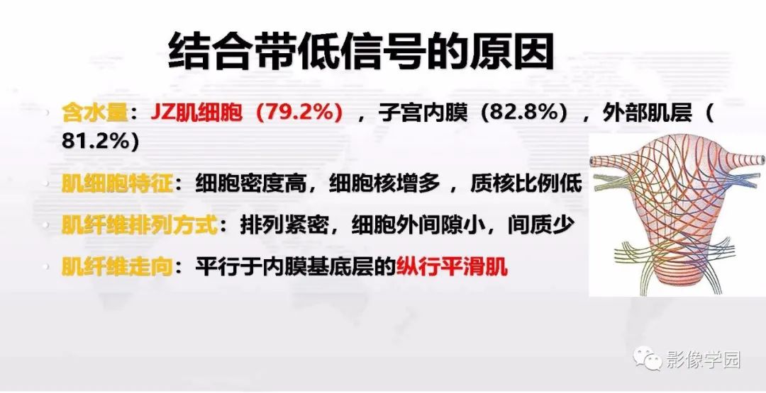影像PPT - 【PPT】子宫内膜癌MR诊断与鉴别-17