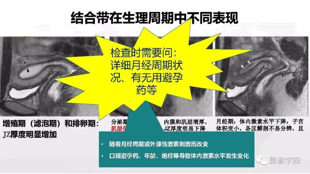 影像PPT - 【PPT】子宫内膜癌MR诊断与鉴别-18