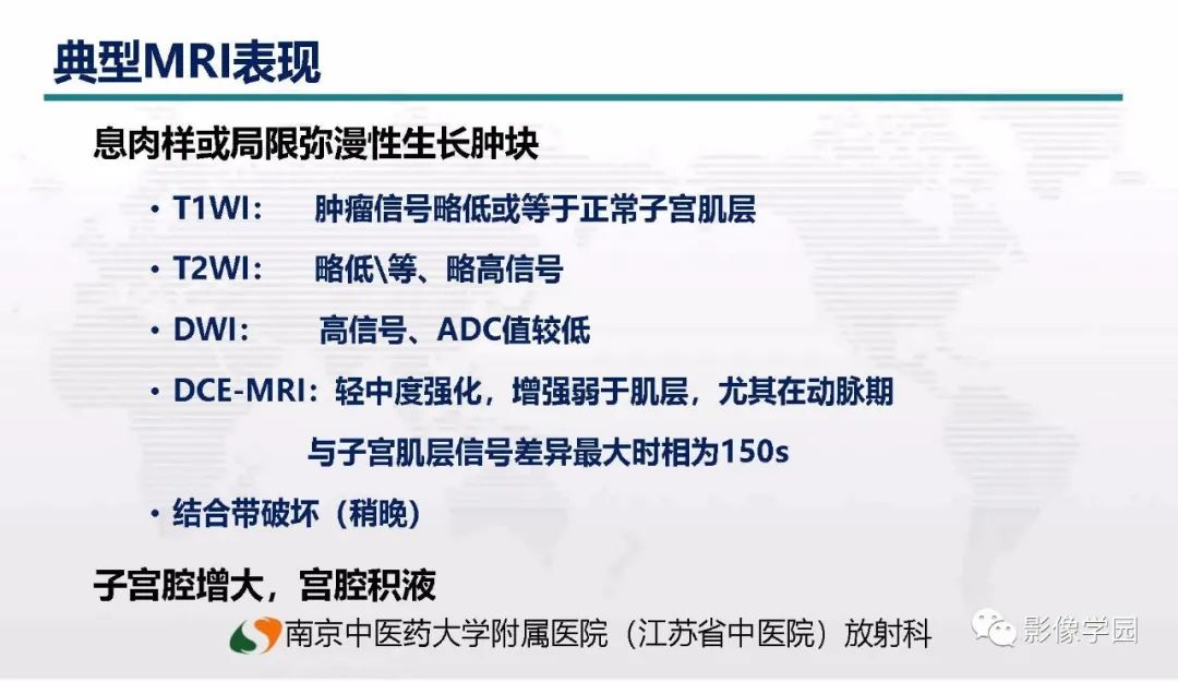 影像PPT - 【PPT】子宫内膜癌MR诊断与鉴别-29