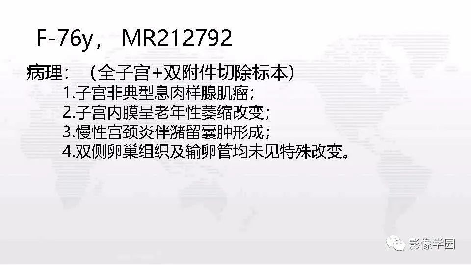 影像PPT - 【PPT】子宫内膜癌MR诊断与鉴别-73