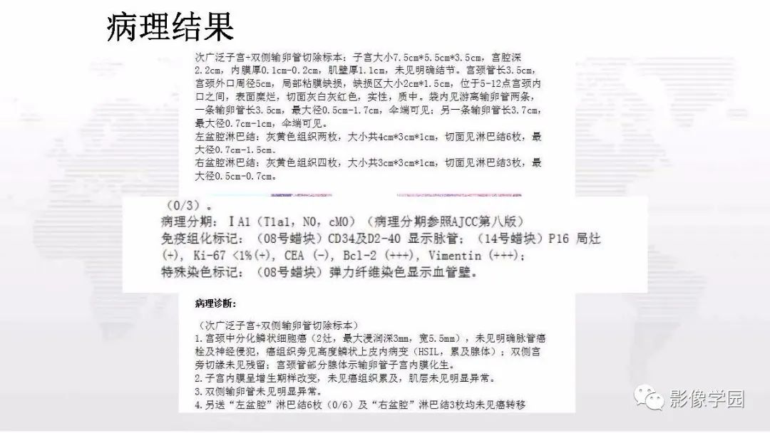 影像PPT - 【PPT】子宫内膜癌MR诊断与鉴别-108