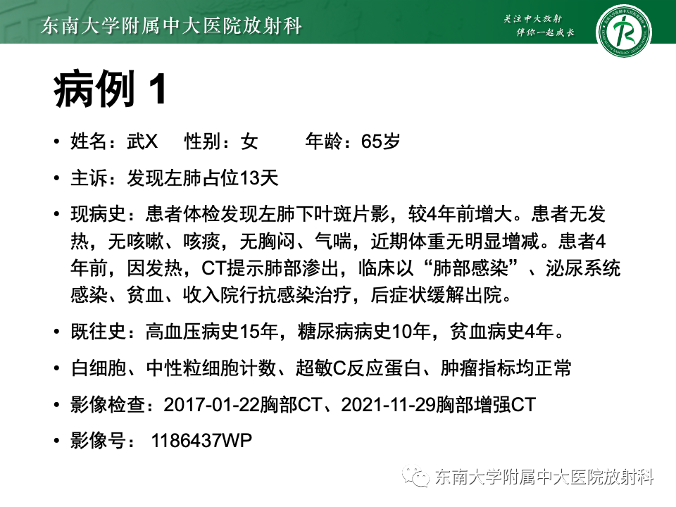 影像PPT - 【PPT】肺炎型黏液腺癌的CT表现-4