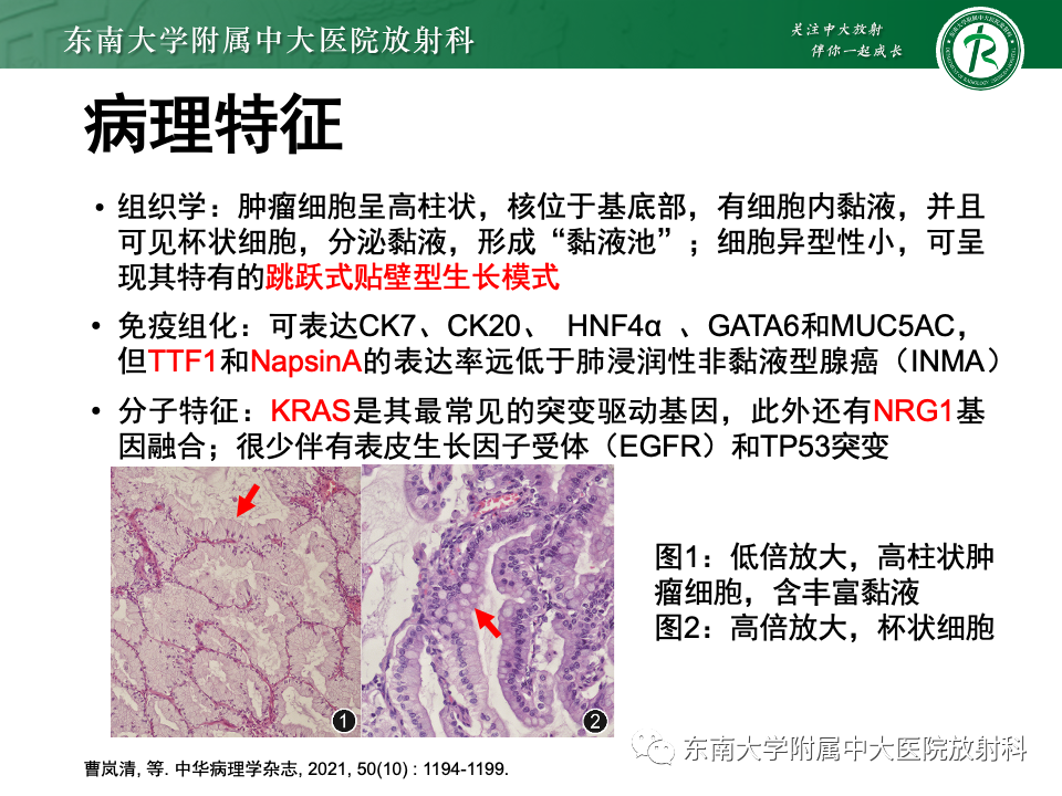 影像PPT - 【PPT】肺炎型黏液腺癌的CT表现-10