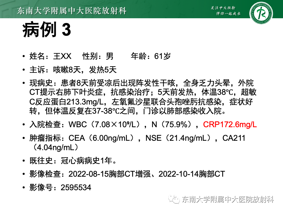 影像PPT - 【PPT】肺炎型黏液腺癌的CT表现-21