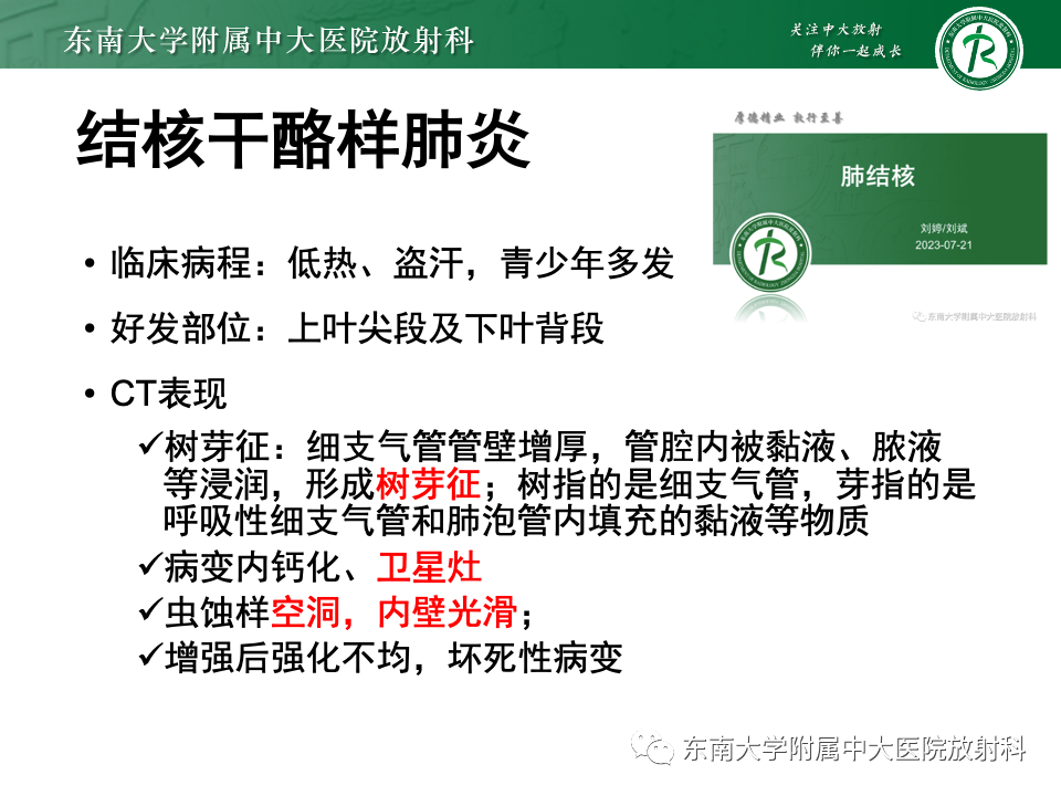 影像PPT - 【PPT】肺炎型黏液腺癌的CT表现-29